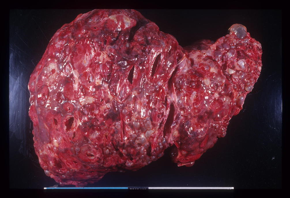 Liver Disease | France | PDF | PPT| Case Reports | Symptoms | Treatment