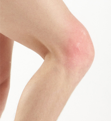 Case study 10 the woman with sore knees image