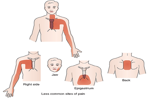 Acid Reflux | Ireland | PDF | PPT| Case Reports | Symptoms | Treatment Acid Reflux | Ireland | PDF | PPT| Case Reports | Symptoms | Treatment