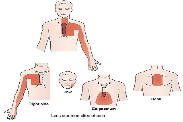 What are some of the symptoms of gastroesophageal reflux disease?