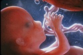 amniotic fluid embolism occurrence amniotic fluid embolism occurrence