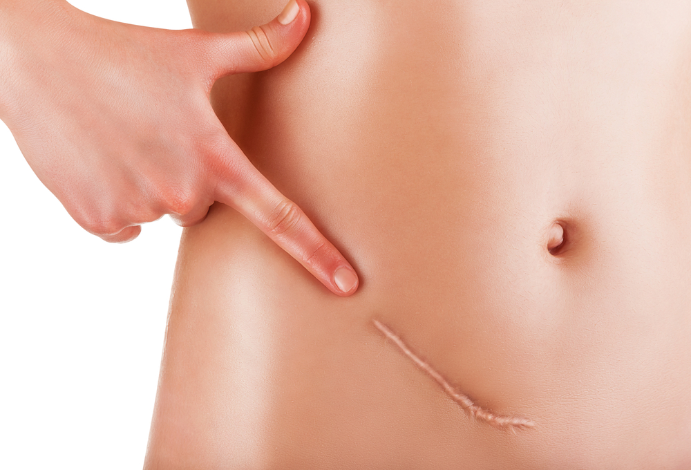 appendicitis india pdf ppt case reports symptoms treatment