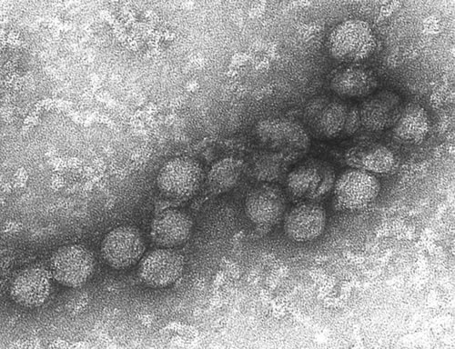 Arenavirus infection