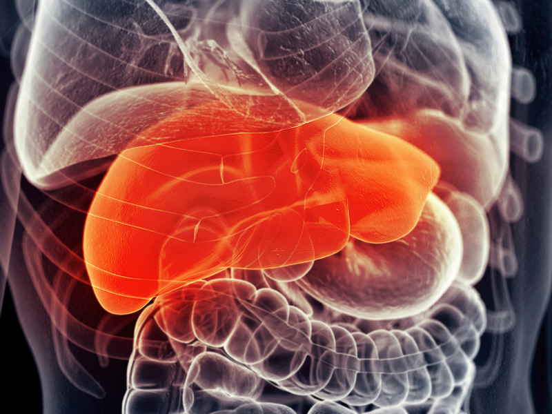 Autoimmune hepatitis Singapore PDF PPT Case Reports Symptoms