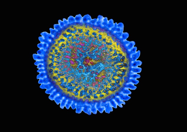 Avian Influenza