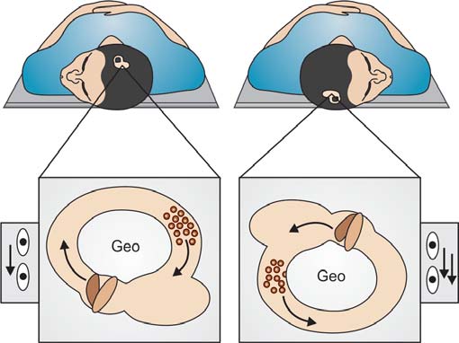 Benign Paroxysmal Positional Vertigo Clinical Characteristics Of 