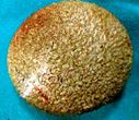 cystoscopy report sle bladder stones japan pdf ppt reports cystoscopy report sle bladder stones japan pdf ppt reports