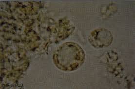 Кристаллы шарко в кале. Blastocystis Hominis. Blastocystis Hominis микроскопия. Цисты бластоцисты хоминис. Blastocystis Hominis трофозоиты.