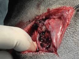 Bone cancer | India| PDF | PPT| Case Reports | Symptoms | Treatment