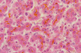 test blood lft Pregnancy PPT  Australia   PDF Cholestasis  Case   of