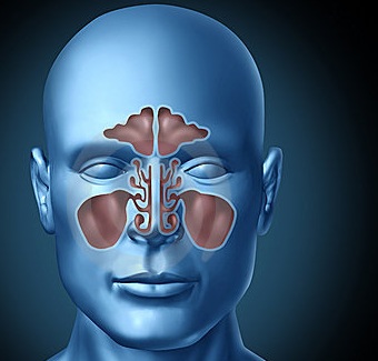 Oral corticosteroids sinusitis