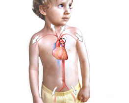 Congenital heart defects in children