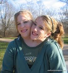 Conjoined twins and sexual behavior Anna polish pornstar