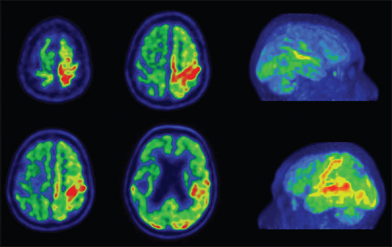 Biological aspects of fluorine - Wikipedia