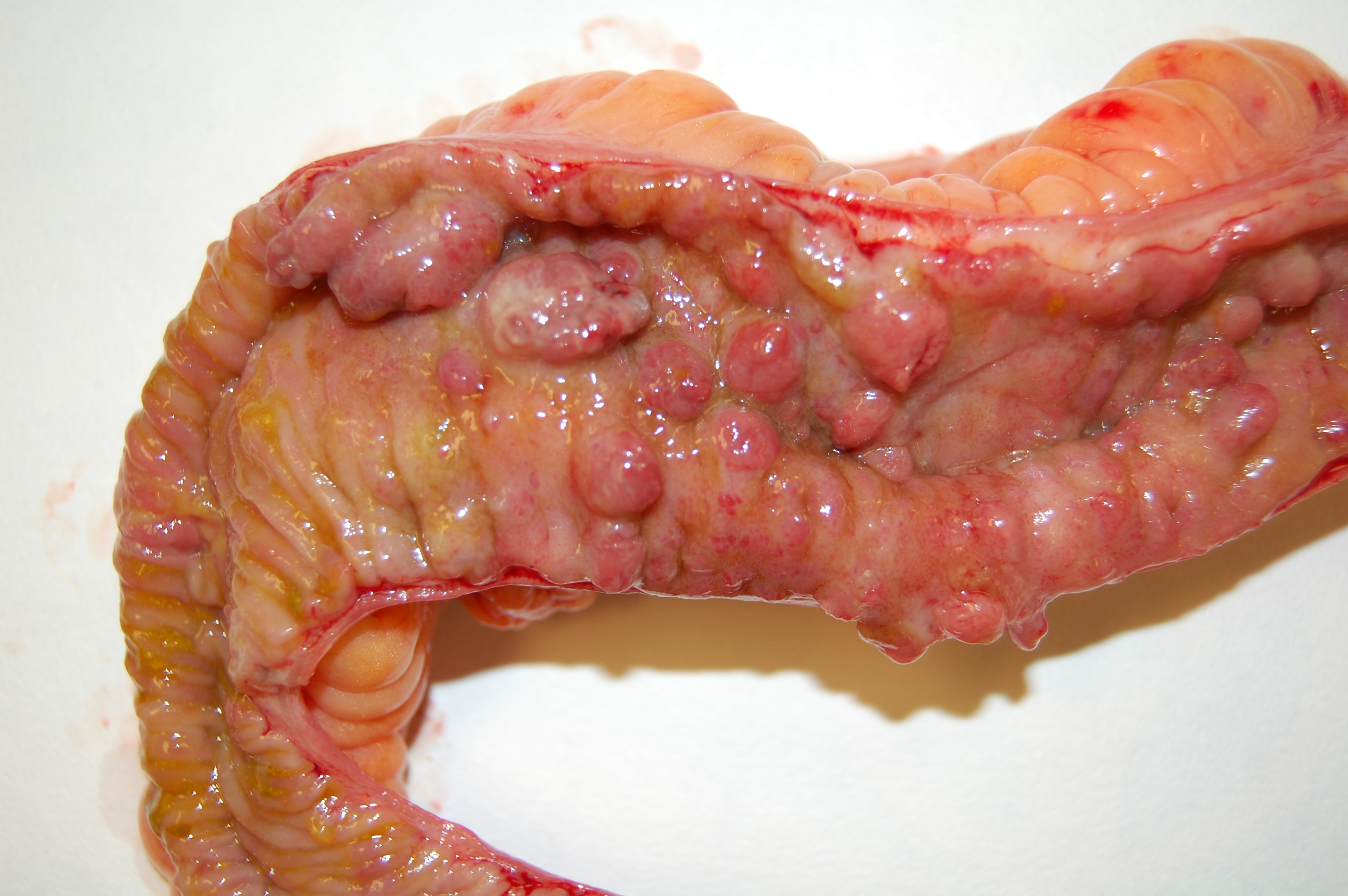 Livedo Reticularis - Causes, Pictures, Treatment Livedo Reticularis - Causes, Pictures, Treatment