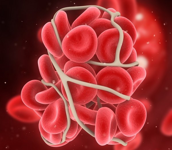 deep vein thrombosis russian federation pdf ppt case reports