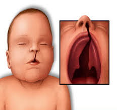 Sindrome Velocardiofacial Epub Download
