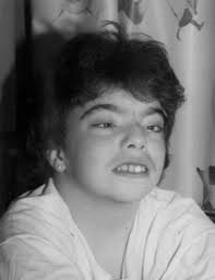 digeorge syndrome singapore pdf ppt case reports symptoms