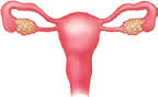 Double uterus