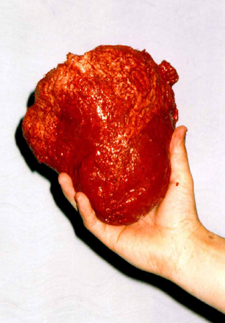 peer reviewed article heart disease Coronary heart disease (chd) is responsible for 45% of on-duty deaths among united states firefighters open peer review firefighters and on-duty deaths from . peer reviewed article heart disease Coronary heart disease (chd) is responsible for 45% of on-duty deaths among united states firefighters open peer review firefighters and on-duty deaths from .