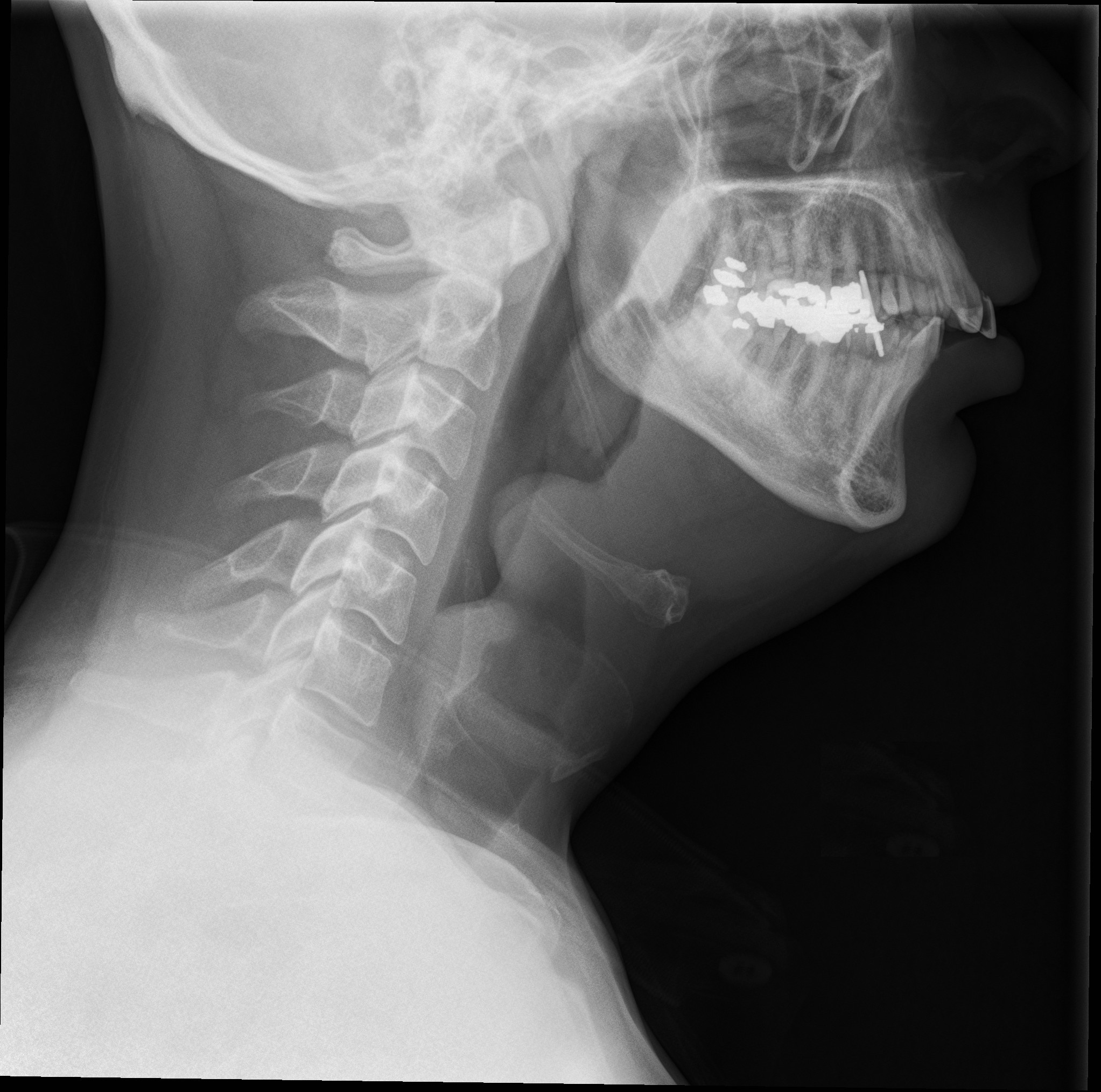 X Ray Deepthroat | Sex Pictures Pass