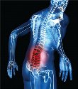 Ergonomic and Musculoskeletal Disorders