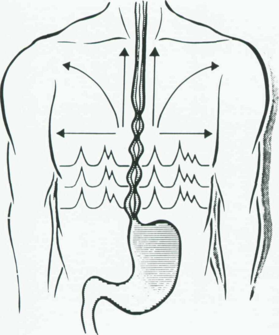 Esophageal spasms