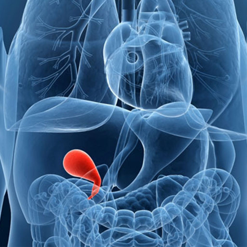 Stages Of Gallbladder Cancer