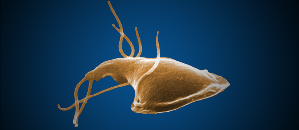 giardia disease)