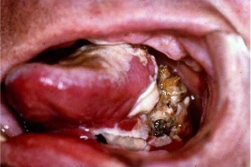 White Gums In Cat With Pancreatic Cancer White Gums In Cat With Pancreatic Cancer