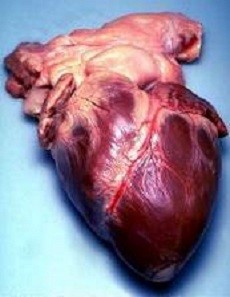 Heart diseases & Genetics