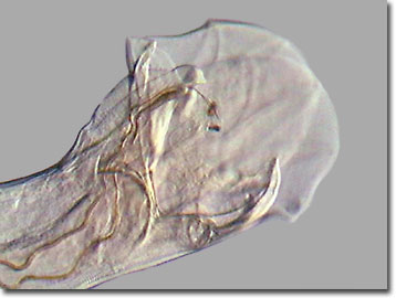 hookworms in humans diagnosis hookworms in humans diagnosis