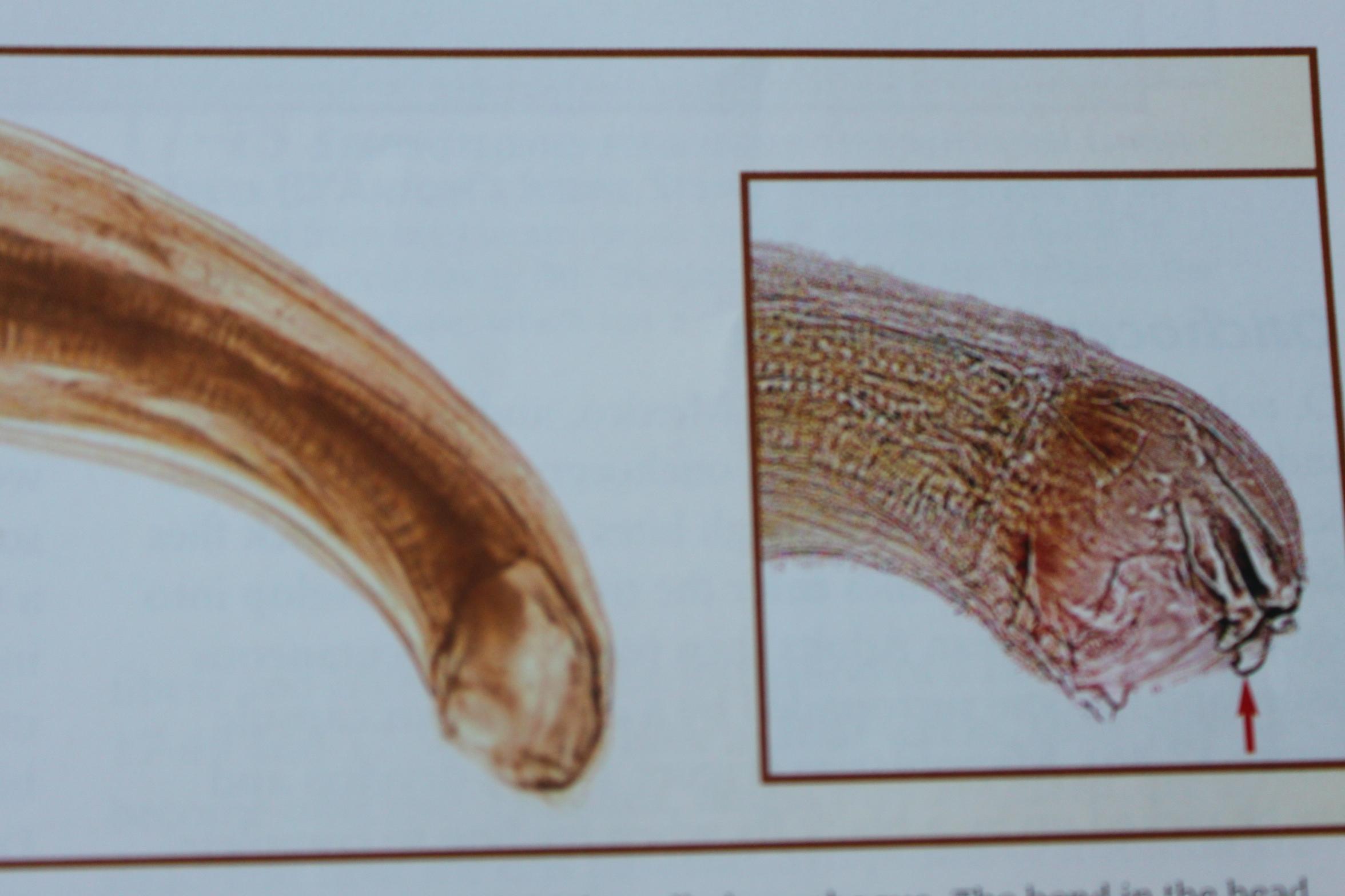 Human Hookworm | Brazil| PDF | PPT| Case Reports | Symptoms | Treatment