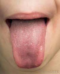 human papillomavirus infection in mouth