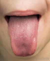 human papillomavirus infection damage