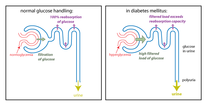 Hyperglycemia in diabetes | France| PDF | PPT| Case Reports | Symptoms
