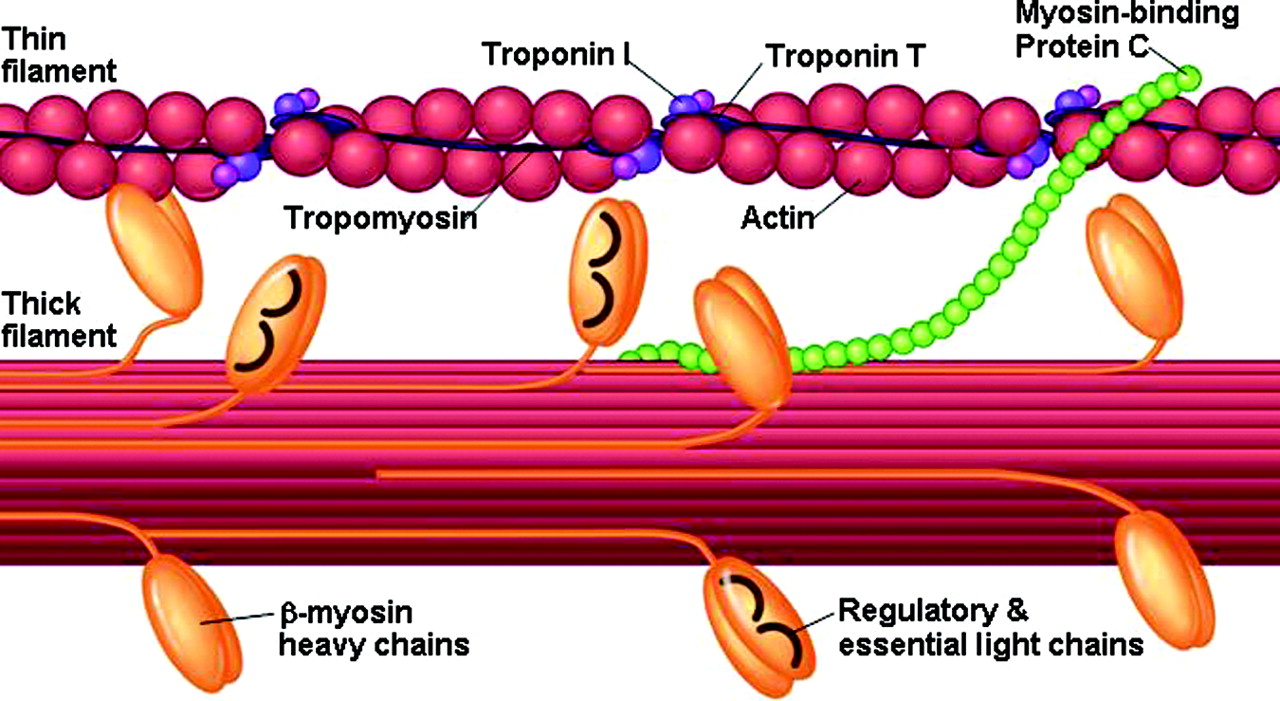 cardiomyopathy hypertrophic paper term cardiomyopathy hypertrophic paper term