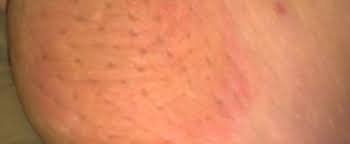 10 Early Symptoms of Cancer in Men