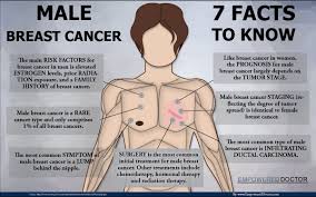 sore male breast Sore male breast