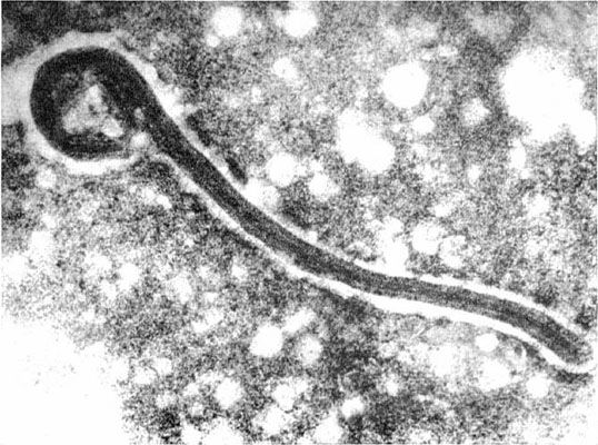 Marburg Virus