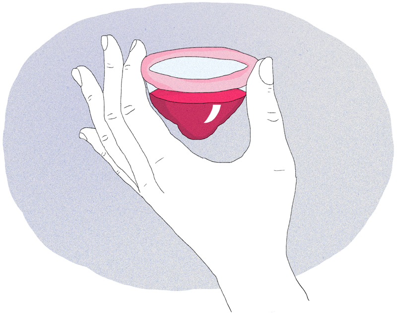 Menorrhagia