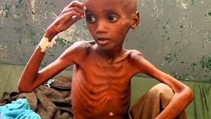 micronutrient malnutrition australia pdf