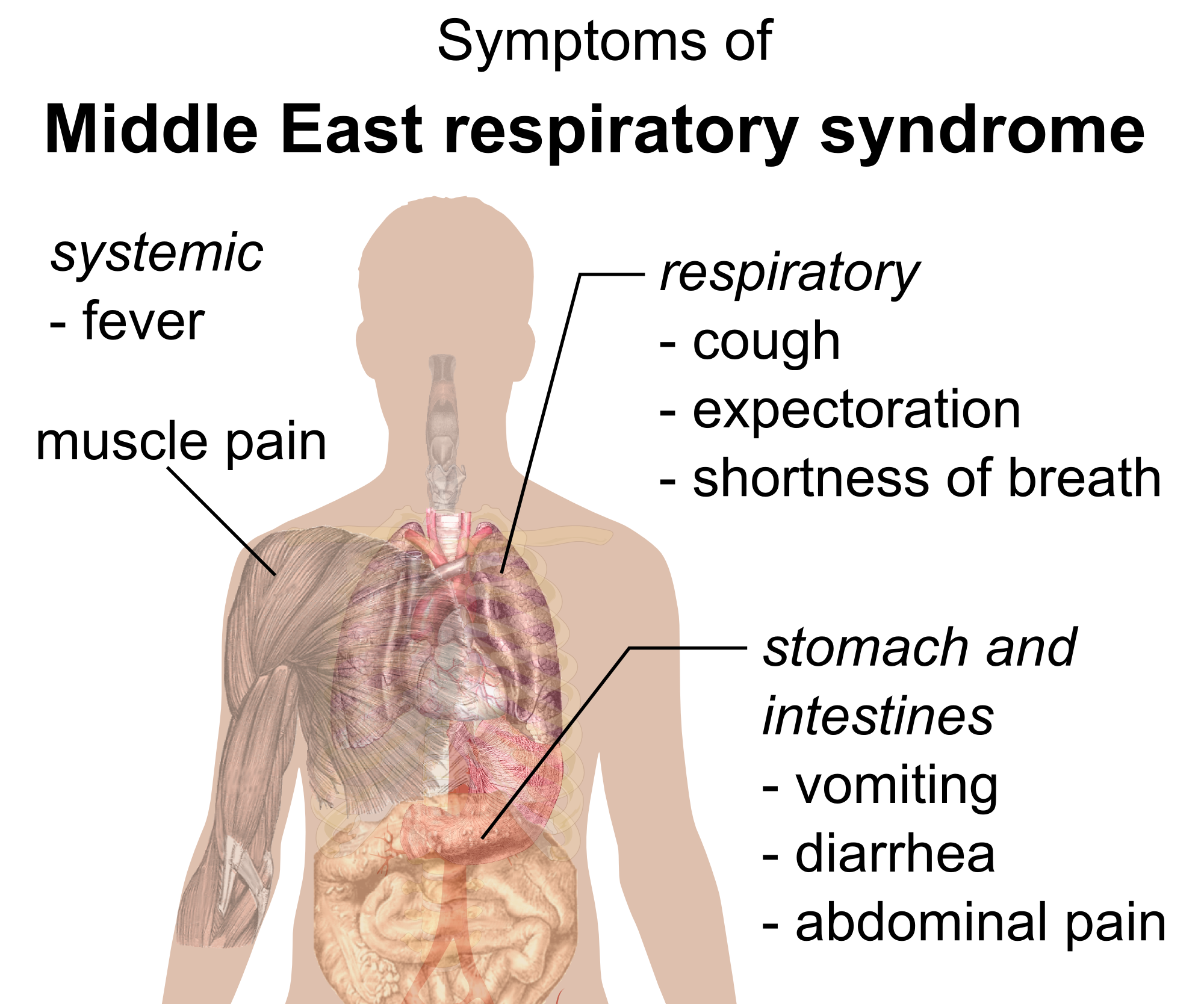 Middle East Respiratory Syndrome Coronavirus | Finland| PDF | PPT| Case Reports ...2000 x 1668