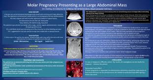 Molar pregnancy