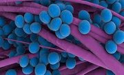 MRSA [Methicillin Resistant Staphylococcus aureus]
