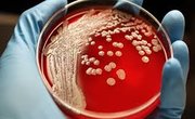 MRSA [Methicillin Resistant Staphylococcus aureus]