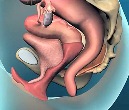 Pelvic organ prolapse