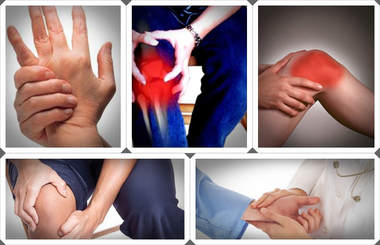 Polymyalgia rheumatica