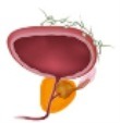 prostatitis ppt for nurses