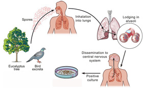 Psittacosis | Australia| PDF | PPT| Case Reports ... pertussis cell diagram 